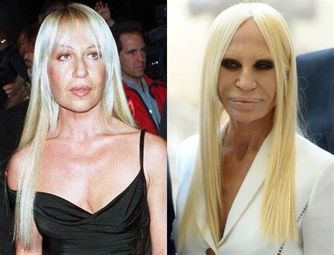 donatella versace boutique italia|donatella versace before and after surgery.